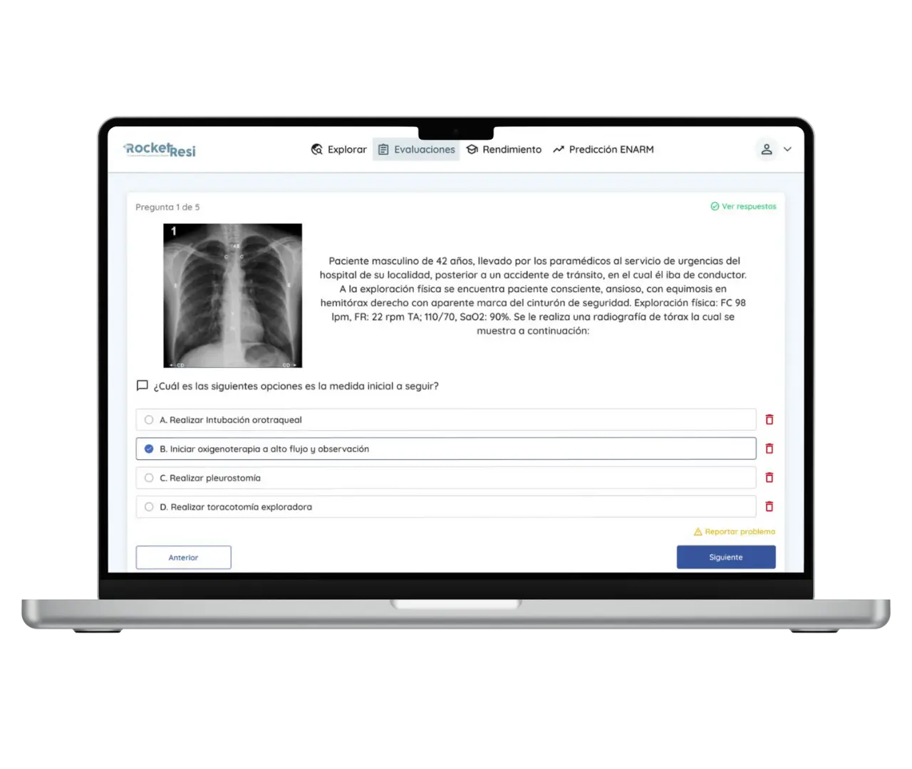 Ejemplo de caso clínico tipo ENARM con opciones de respuesta